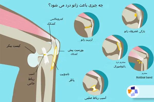 درمان زانو درد فوری با راهکارهای مختلف|مجله طبی