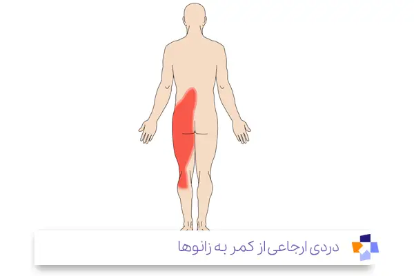 درد، از علائم درد کمر و زانو|مجله طبی