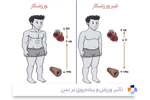 تاثیر پیاده روی برای درد سیاتیک بر عضلات و بدن|مجله طبی