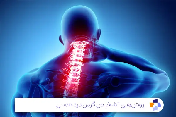 علت گردن درد عصبی در اغلب موارد رادیکولوپاتی است|مجله طبی