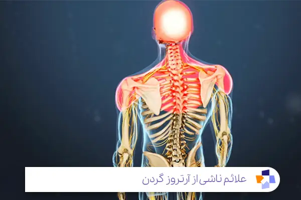 علائم آرتروز گردن؛ از بی حسی تا مشکل در خواب|مجله طبی