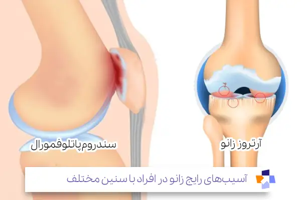 علت درد پا از زانو به پایین در جوانی|مجله طبی