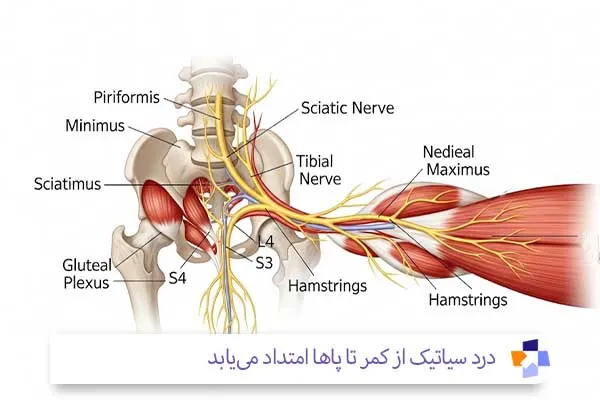 ورزش سیاتیک | مجله طبی