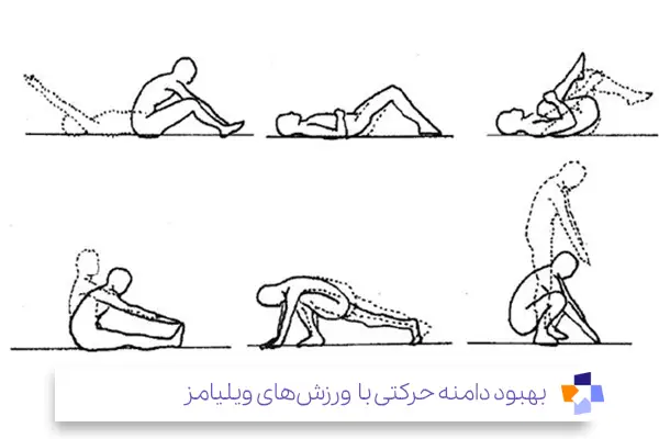 ورزشهای ویلیامز برای سیاتیک|مجله طبی