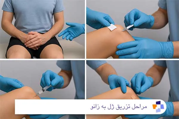 مراحل تزریق ژل به زانو | مجله طبی