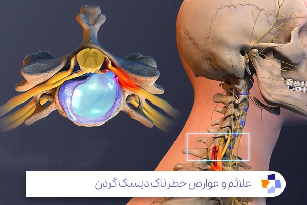 آیا درد پشت سر خطرناک است؟|مجله طبی