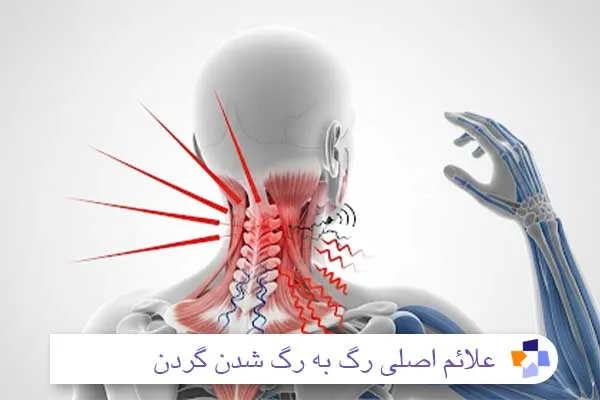 اصلی رگ به رگ شدن گردن | مجله طبی