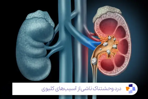 مشکلات کلیوی؛ علت‌های مخفی اما جدی کمر درد و درد زیر شکم|مجله طبی