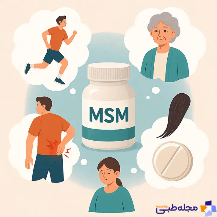 MSM برای چه کسانی مفید است | مجله طبی