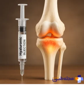 آمپول هیالورونیک اسید | مجله طبی