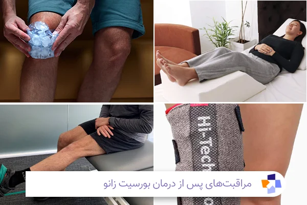 مراقبت‌های پس از درمان بورسیت زانو | مجله طبی