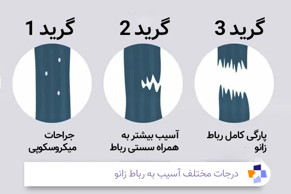گرید آسیب رباط زانو | مجله طبی