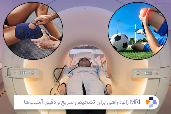 چه زمانی باید ام آر آی زانو انجام داد؟ | مجله طبی