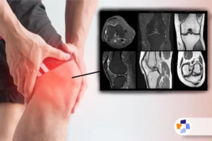 ام آر آی زانو | مجله طبی