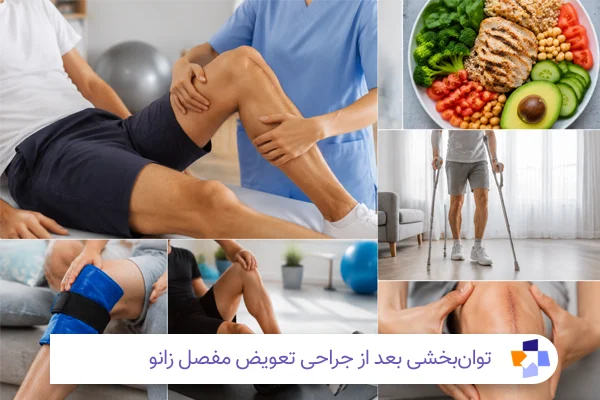مراقبتهای بعد از جراحی تعویض مفصل زانو| مجله طبی