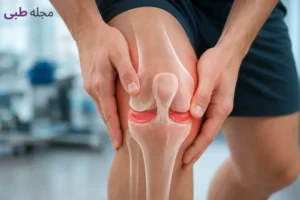 مینیسک زانو چیست و کجاست