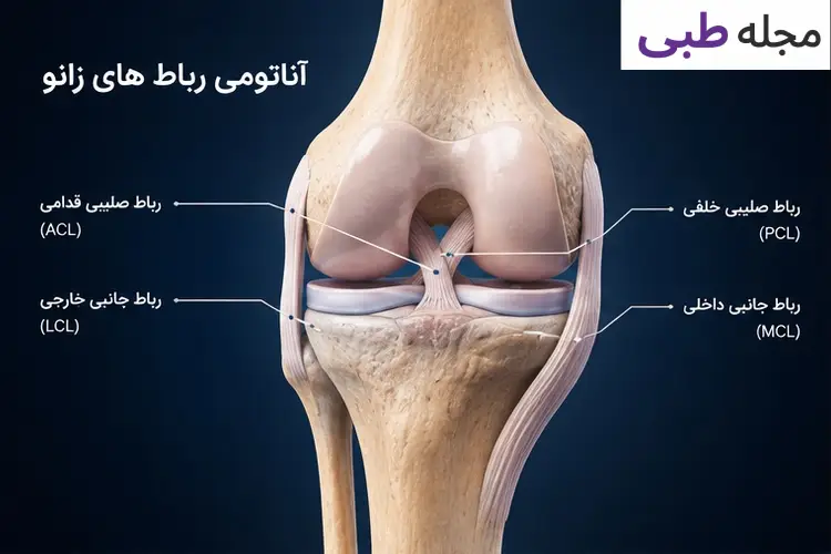 علائم کلی پارگی رباط زانو
