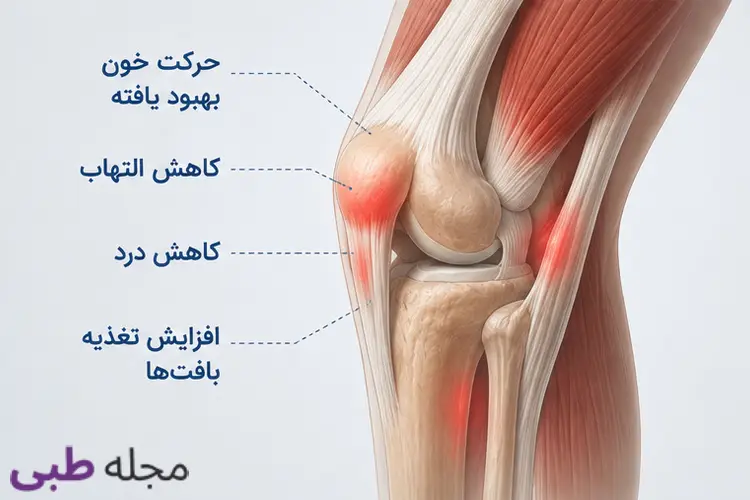 اثرات کلی حجامت زانو